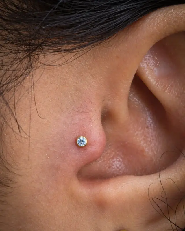 Tragus